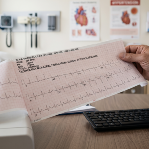 Electrocardiograma